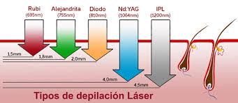 Depilacion Laser - Ana Camarero